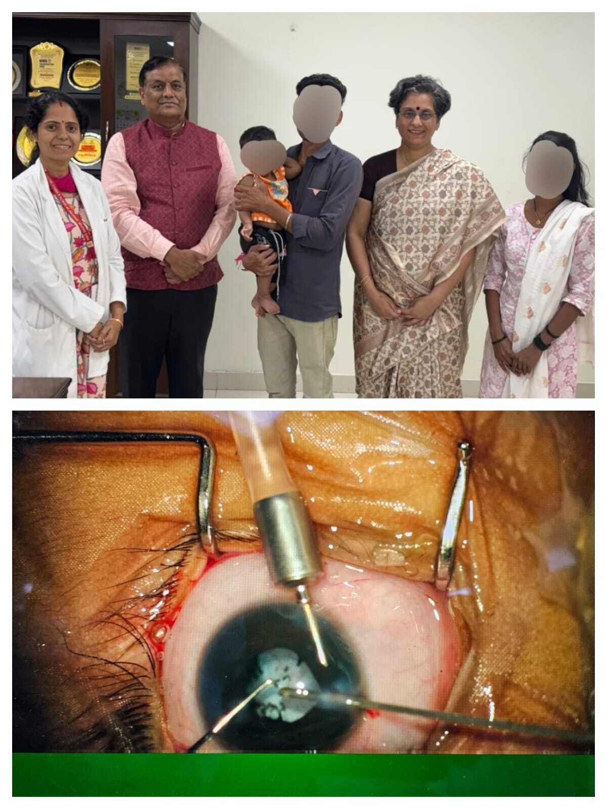AIIMS Nagpur Performs Complex ROP Surgery on 13-Month-Old Child